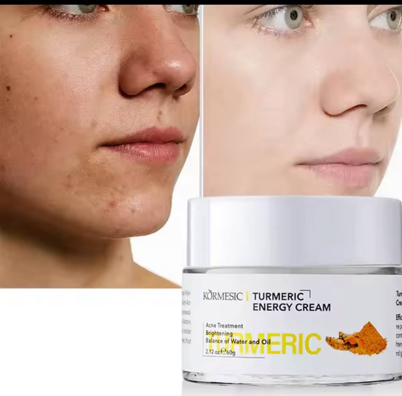 Tumeric face moisturizer - Image 4